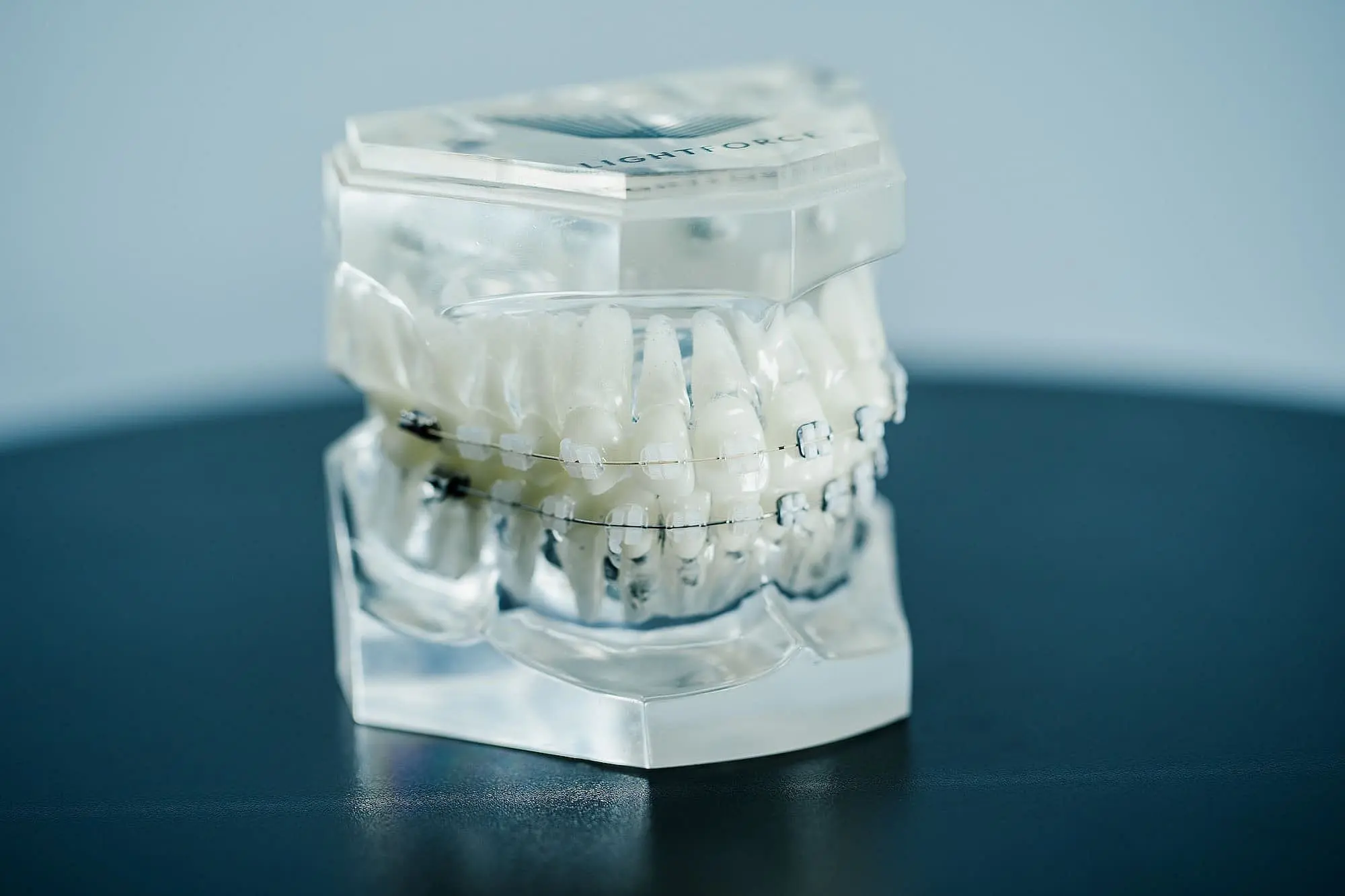 A clear dental model with LightForce Braces, shown by Emerald City Orthodontics in Kirkland, WA on a dark surface, pale background.