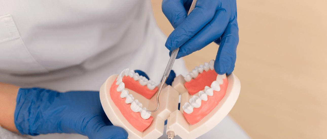 At Emerald City Orthodontics in Kirkland, WA, blue-gloved hands demonstrate correcting an overbite on plastic dental model teeth.