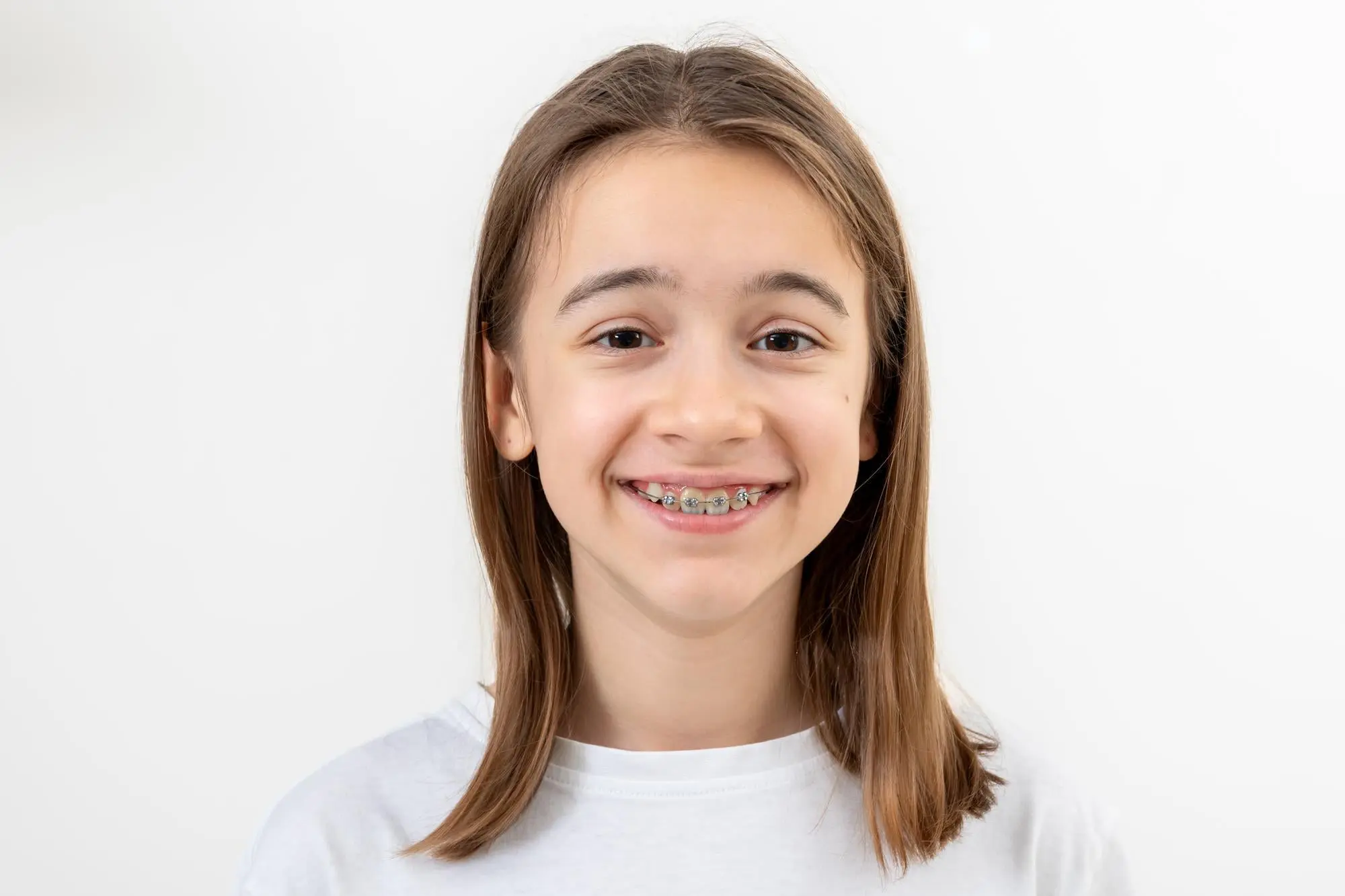 A smiling young person with braces at Emerald City Orthodontics in Kirkland WA, stands against a plain white background.