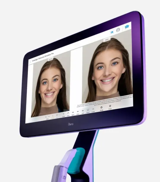 A computer screen at Emerald City Orthodontics in Kirkland, WA shows a woman’s before-and-after dental simulation side by side.