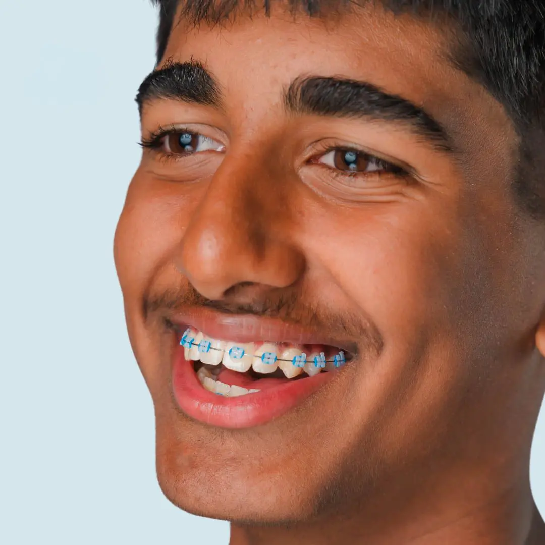 Smiling teenage boy with short dark hair and clear braces at Emerald City Orthodontics in Kirkland WA, against blue background.