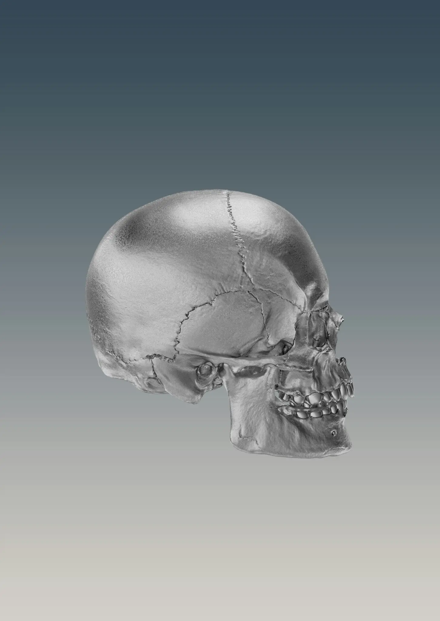 A metallic human skull model in profile highlights overjet and overbite causes for Emerald City Orthodontics in Kirkland, WA.