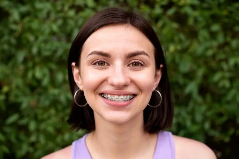 Smiling young person with short dark hair, hoop earrings, and braces at Emerald City Orthodontics in Kirkland, WA. Greenery behind - How to Get Braces Glue Off Teeth in Kirkland, WA
