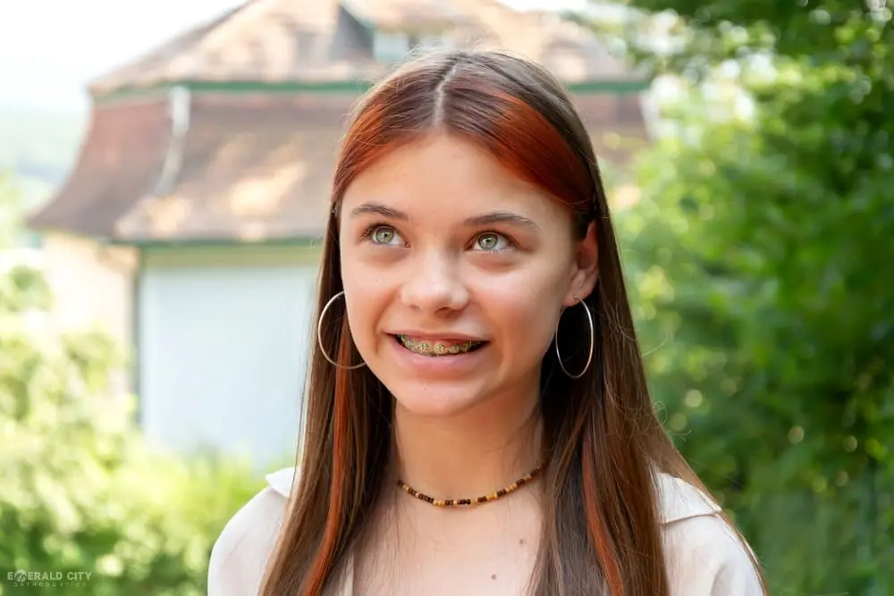 A teenage girl with braces and jewelry stands outside near greenery and a building, at Emerald City Orthodontics in Kirkland, WA - How to Fix Overbite in Kirkland, WA 