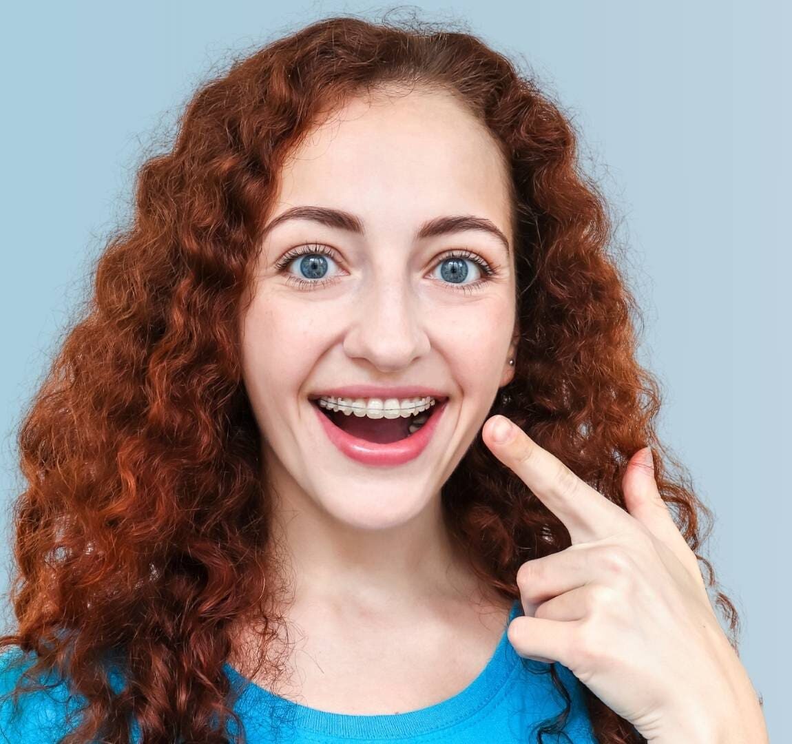 Smiling young woman with curly red hair points to her adult clear braces, promoting Emerald City Orthodontics in Kirkland, WA.